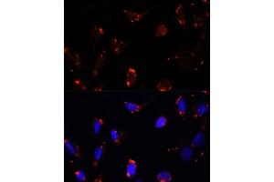 Immunofluorescence analysis of U-2 OS cells using TBRG4 antibody  at dilution of 1:100. (TBRG4 抗体  (AA 382-631))