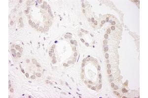 anti-Ubiquitin Specific Peptidase 34 (USP34) (C-Term) antibody
