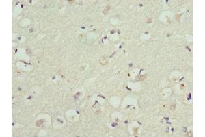 Immunohistochemistry of paraffin-embedded human brain tissue using ABIN7157744 at dilution of 1:100 (KCNIP2 抗体  (AA 1-90))