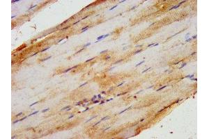 IHC image of ABIN7155861 diluted at 1:200 and staining in paraffin-embedded human skeletal muscle tissue performed on a Leica BondTM system.