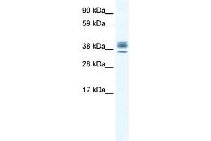 WB Suggested Anti-ESX1 Antibody Titration:  2. (ESX Homeobox 1 抗体  (N-Term))