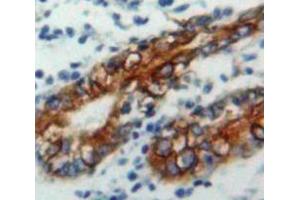 IHC-P analysis of Stomach tissue, with DAB staining. (CD79a 抗体  (AA 36-219))