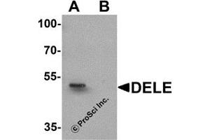 Western Blotting (WB) image for anti-DAP3 Binding Cell Death Enhancer 1 (DELE1) (N-Term) antibody (ABIN1031350) (DELE1/KIAA0141 抗体  (N-Term))