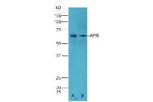 Lane A: Mouse Heart lysate Lane B: Mouse Pancreas lysates probed with Rabbit Anti-API5 Polyclonal Antibody, Unconjugated (ABIN673959) at 1:300 overnight at 4 °C. (Apoptosis Inhibitor 5 抗体  (AA 351-460))