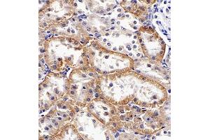Immunohistochemistry of paraffin embedded rat kidney using SLC7A8 (ABIN7074503) at dilution of 1:1100 (400x lens) (LAT2 抗体)