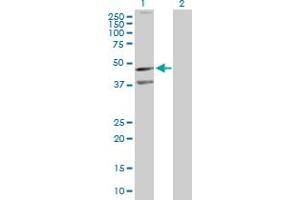 Western Blot analysis of CXCR5 expression in transfected 293T cell line by CXCR5 MaxPab polyclonal antibody. (CXCR5 抗体  (AA 1-372))