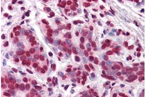 Human Breast: Formalin-Fixed, Paraffin-Embedded (FFPE) (Vitamin D Receptor 抗体  (AA 1-428))