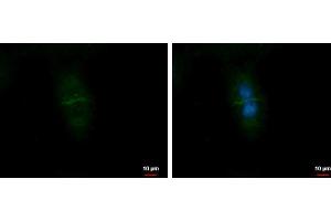 ICC/IF Image CD99L2 antibody detects CD99L2 protein at Cell membrane by immunofluorescent analysis. (CD99L2 抗体)