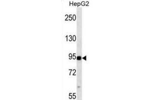 Western Blotting (WB) image for anti-Mitogen-Activated Protein Kinase Kinase Kinase 11 (MAP3K11) antibody (ABIN2938456) (MAP3K11 抗体)