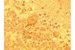 Image no. 1 for anti-Sphingolipid Delta(4)-Desaturase DES1 (DEGS1) antibody (ABIN793733) (DEGS1 抗体)