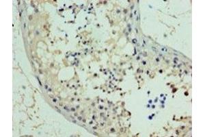 Immunohistochemistry of paraffin-embedded human testis tissue using PA889102LA01HU at dilution of 1:100 (RAD18 抗体  (AA 1-495))