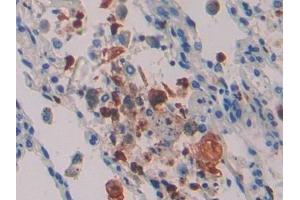 Immunohistochemistry (IHC) image for anti-Interleukin 16 (IL16) (AA 1203-1332) antibody (ABIN7430693)