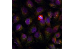 Immunofluorescence staining of methanol-fixed HeLa cells using Phospho-NFKB1-S337 antibody (ABIN2987371). (NFKB1 抗体  (pSer337))