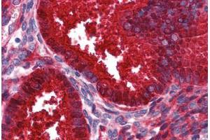 Human Uterus: Formalin-Fixed, Paraffin-Embedded (FFPE) (SERPING1 抗体  (AA 1-501))