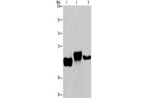 Gel: 6 % SDS-PAGE, Lysate: 40 μg, Lane 1-3: Human placenta tissue, Human fetal liver tissue, HepG2 cells, Primary antibody: ABIN7192345(SGK2 Antibody) at dilution 1/100, Secondary antibody: Goat anti rabbit IgG at 1/8000 dilution, Exposure time: 8 minutes (SGK2 抗体)