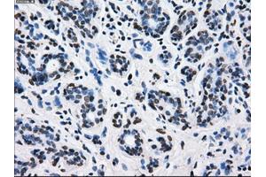 Immunohistochemical staining of paraffin-embedded breast tissue using anti-L1CAM mouse monoclonal antibody. (L1CAM 抗体)