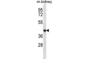 Western Blotting (WB) image for anti-Tenomodulin (TNMD) antibody (ABIN2996886) (TNMD 抗体)