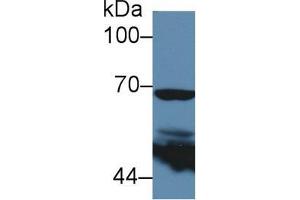 Western blot analysis of Human 293T cell lysate, using Mouse PTGS2 Antibody (5 µg/ml) and HRP-conjugated Goat Anti-Rabbit antibody ( (PTGS2 抗体  (AA 240-351))