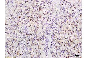Formalin-fixed and paraffin embedded rat small intestine tissue labeled with Anti phospho-CD32B(Tyr291) Polyclonal Antibody,Unconjugated (ABIN761411) at 1:200 followed by conjugation to the secondary antibody and DAB staining.