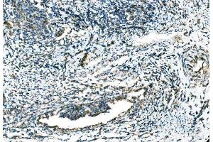 IHC analysis of CCR2 using anti-CCR2 antibody (ABIN7602136).