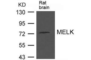Western blot analysis of extract from Rat brain tissue using MELK Antibody (MELK 抗体)