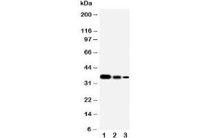 Western blot testing of SHC antibody and Lane 1:  Recombinant human protein 10ng;  2: 5ng;  3: 2.