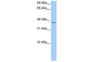 PCBP1 antibody used at 1 ug/ml to detect target protein. (PCBP1 抗体)