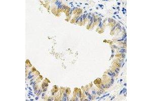 Immunohistochemical analysis of COQ7 staining in mouse lung formalin fixed paraffin embedded tissue section. (Coq7 抗体)