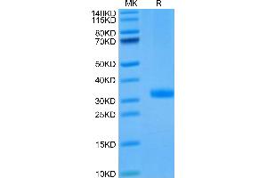 Angiopoietin 2 Protein (ANGPT2) (AA 275-496) (His tag)