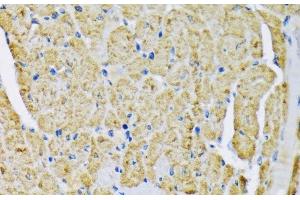 Immunohistochemistry of paraffin-embedded Mouse heart using HK2 Polyclonal Antibody at dilution of 1:200 (40x lens). (Hexokinase 2 抗体)