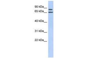 Image no. 1 for anti-Fibrous Sheath Interacting Protein 1 (FSIP1) (AA 287-336) antibody (ABIN6741216) (FSIP1 抗体  (AA 287-336))