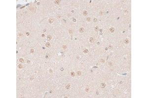 Immunohistochemistry of paraffin-embedded Mouse brain using HMGN1 Polyclonal Antibody at dilution of 1:100 (40x lens). (HMGN1 抗体)