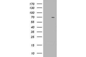 Western Blotting (WB) image for anti-Tripartite Motif Containing 2 (TRIM2) (AA 1-100), (AA 645-744) antibody (ABIN1490542) (TRIM2 抗体  (AA 1-100, AA 645-744))