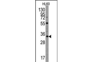 Western blot analysis of UBTD1 Antibody (C-term ) (ABIN387937 and ABIN2844471) in Hl60 cell line lysates (35 μg/lane). (UBTD1 抗体  (C-Term))
