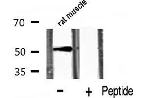 Western blot analysis of p53 phosphorylation expression in rat muscle lysates,The lane on the right is treated with the antigen-specific peptide. (p53 抗体  (pSer20))