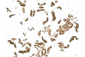Immunocytochemistry (ICC) image for anti-Keratin 14 (KRT14) (C-Term) antibody (ABIN7795698)