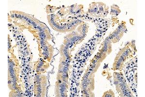 ABIN6259596 and ABIN6275561 at 1/100 staining rat colorectal tissue by IHC-P. (SH2D2A 抗体  (C-Term))