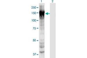 Western Blot analysis of MYO1E expression in transfected 293T cell line by MYO1E monoclonal antibody (M02), clone 7A5. (MYO1E 抗体  (AA 918-1014))