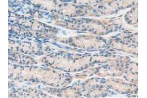 IHC-P analysis of Mouse Intestine Tissue, with DAB staining. (PTPRJ 抗体  (AA 567-842))