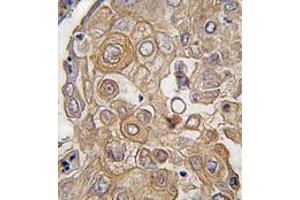 Image no. 3 for anti-Toll-Like Receptor 6 (TLR6) (C-Term) antibody (ABIN357053) (TLR6 抗体  (C-Term))