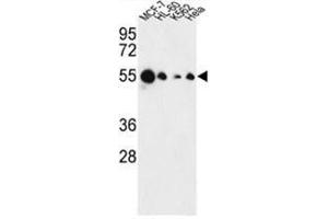 Western blot analysis of AIM2 Antibody (N-term) in MCF-7, HL-60, K562, Hela cell line lysates (35 µg/lane).