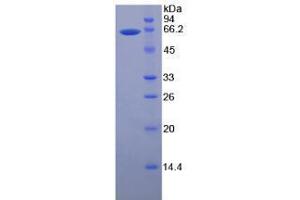Image no. 1 for Matrix Metalloproteinase 2 (MMP2) (AA 110-660) (Active) protein (His tag) (ABIN6239740)