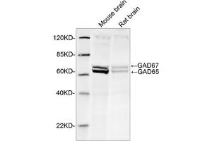 Western blot analysis of tissue lysates using 1 µg/mL Rabbit Anti-GAD65+GAD67 Polyclonal Antibody (ABIN398919) The signal was developed with IRDyeTM 800 Conjugated Goat Anti-Rabbit IgG. (GAD65+GAD67 (AA 550-600) 抗体)