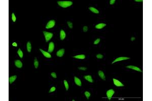 Immunofluorescence of purified MaxPab antibody to HDAC2 on HeLa cell. (HDAC2 抗体  (AA 1-582))