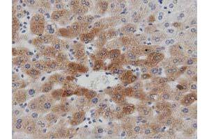 Immunohistochemical staining of paraffin-embedded Human liver tissue using anti-PTPRE mouse monoclonal antibody. (PTPRE 抗体)