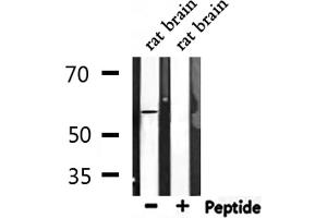 Western blot analysis of extracts from rat brain, using Phospho-ATF2 (Ser62/44) Antibody.