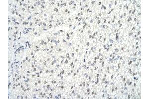 Immunohistochemistry (IHC) image for anti-Glucocorticoid Modulatory Element Binding Protein 2 (GMEB2) (C-Term) antibody (ABIN2780880)