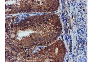 Image no. 5 for anti-Iduronate 2-Sulfatase (IDS) antibody (ABIN1498797)