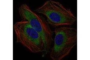 Immunofluorescence analysis of Hela cells using CD59 mouse mAb (green). (CD59 抗体  (AA 31-111))