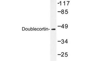 Image no. 2 for anti-Doublecortin (DCX) antibody (ABIN272098) (Doublecortin 抗体)